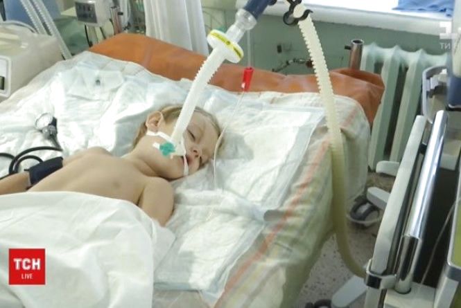 3-річний хлопчик вдавився чупа-чупсом… Нині малюк у лікарні в комі (відео)