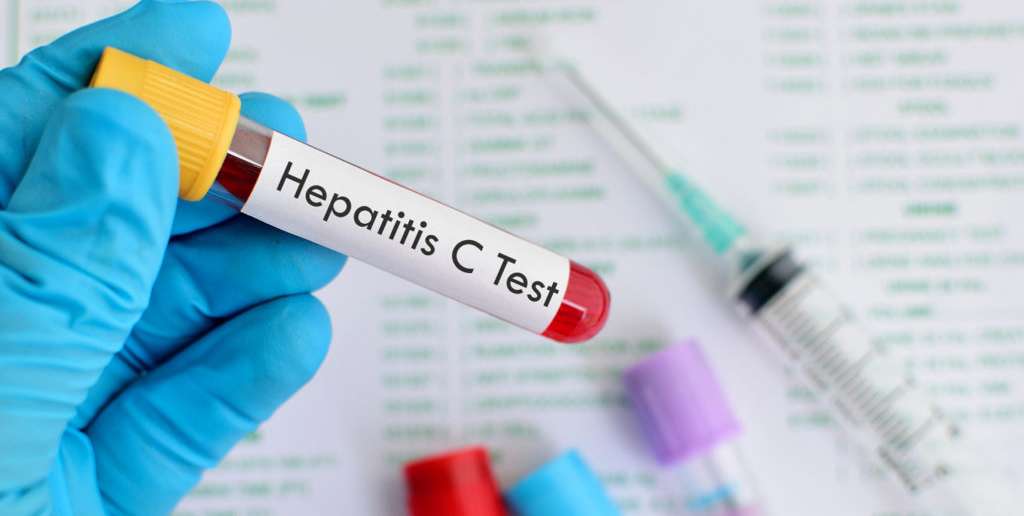 На Вінниччині підтверджено 263 випадки гепатиту А