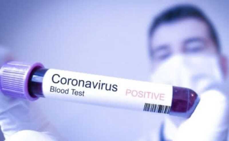 +15 випадків захворювання на коронавірус на Вінниччині