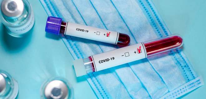 Мати та дитина з Гайсинського району захворіли на коронавірус