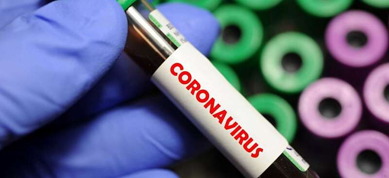На Гайсинщині 8 людей з однієї родини захворіли на коронавірус!