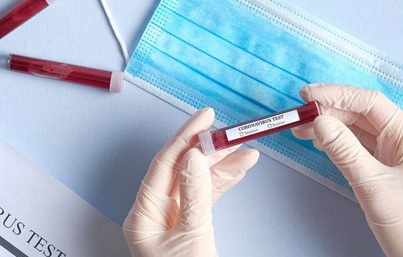 23 випадки захворювання на коронавірус та 78 підозр на Вінниччині