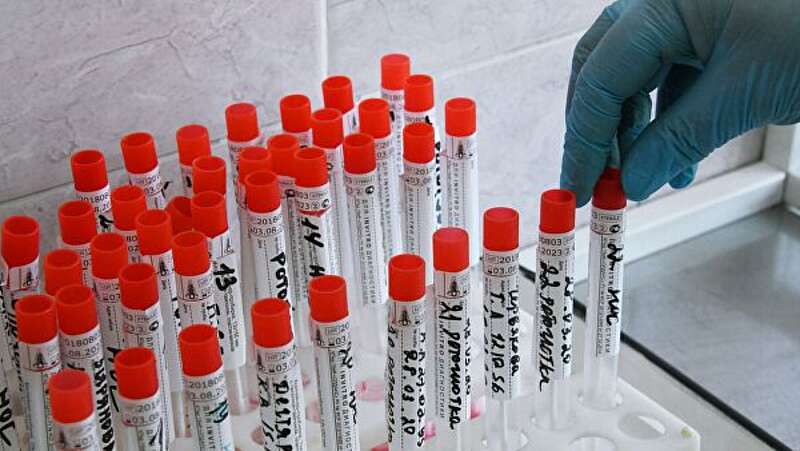 Вісім нових випадків коронавірусу додалося на Вінниччині