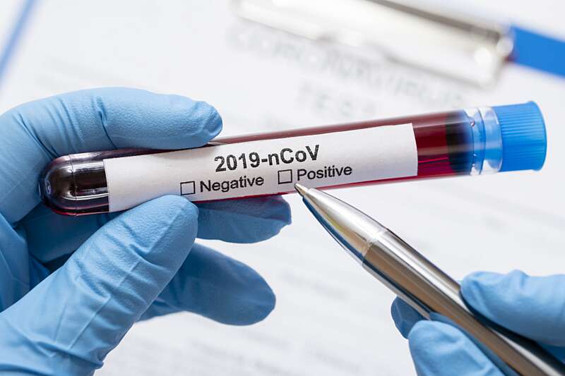 1814 тестів на коронавірус зробили на Вінниччині за період пандемії