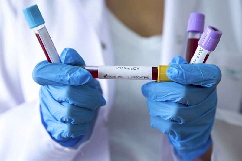 311 нових випадків коронавірусу в Україні за останню добу. З них – 17 – на Вінниччині