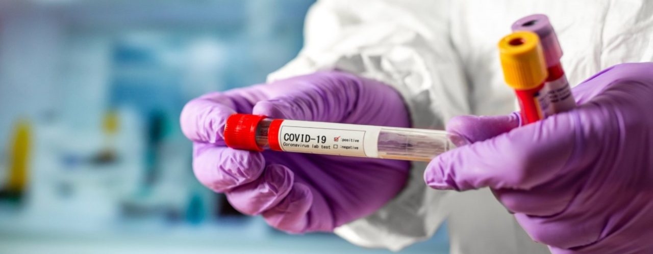 Два місяці тому – перший випадок спалаху коронавірусу на Вінниччині.