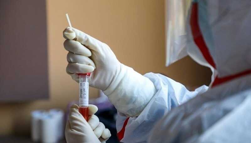 В обласному Центрі СНІДу будуть проводити ПЛР на коронавірус