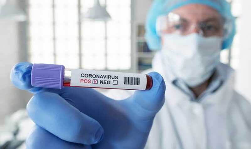 На Вінниччині коронавірус забрав життя 50 жителів області. За минулу добу 3 жертви