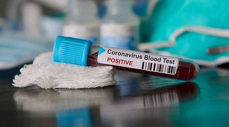 45 випадків коронавірусу на Вінниччині. І 1 летальний