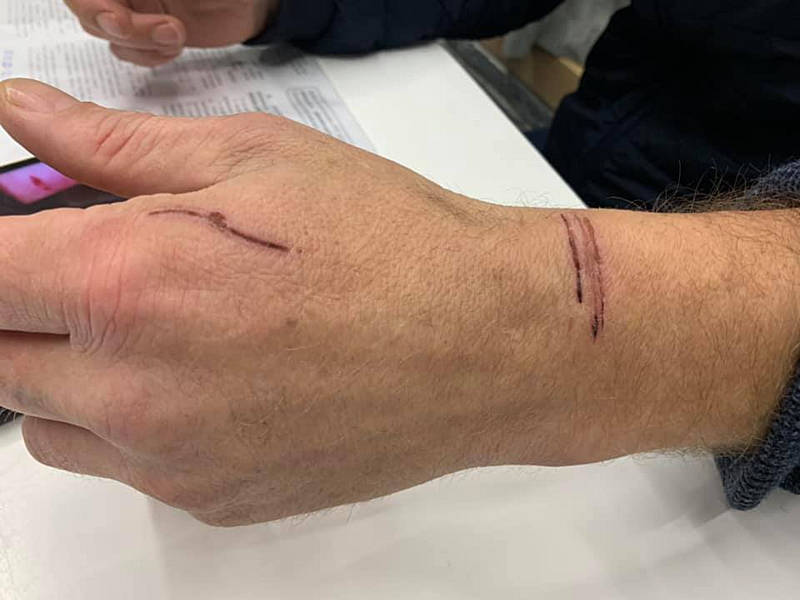 Статтю «непокора поліції» оголосили ветерану АТО, бо зайшов у магазин без маски. Він у свою чергу заявив про знущання та побиття (ОНОВЛЕНО)