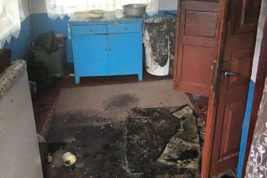 Ледь не згорів будинок на Вінниччині: 82-річний господар отримав опіки