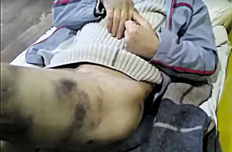 Чому ув’язнені з Крижополя «бунтують» та нарікають, що їх не хочуть лікувати від ковіду?