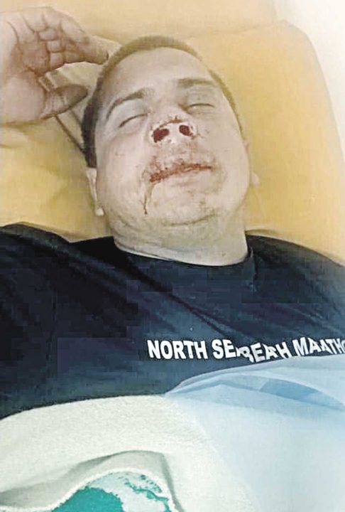 Айдарівця Фокса хотіли вбити у Тиврові. Чому поліція «зливає» справу?