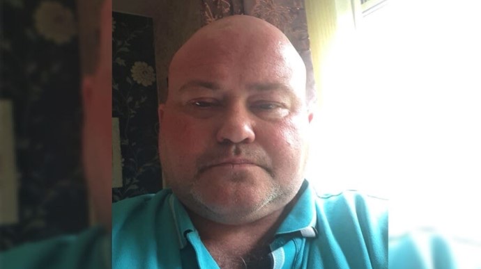 Рашисти британцеві відрізали частини тіла