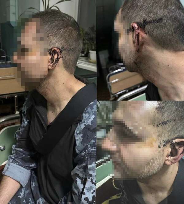 Кривавий інцидент в одній з військових частин Одеської області: відповідальний по В/Ч розбив голову бійцю, — ДБР