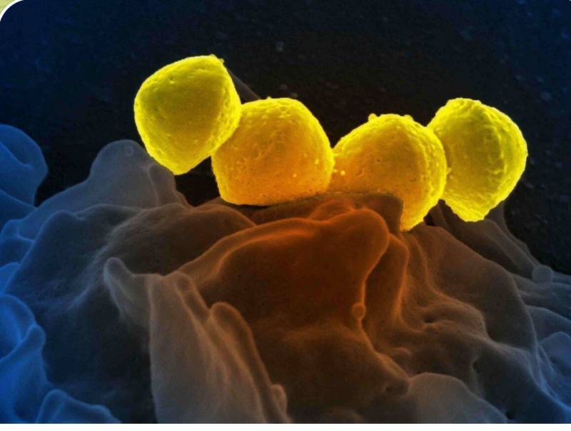 В Японії стрімко шириться вірус, спричинений рідкісною “м’ясоїдною бактерією”, здатною вбити людину протягом 48 годин