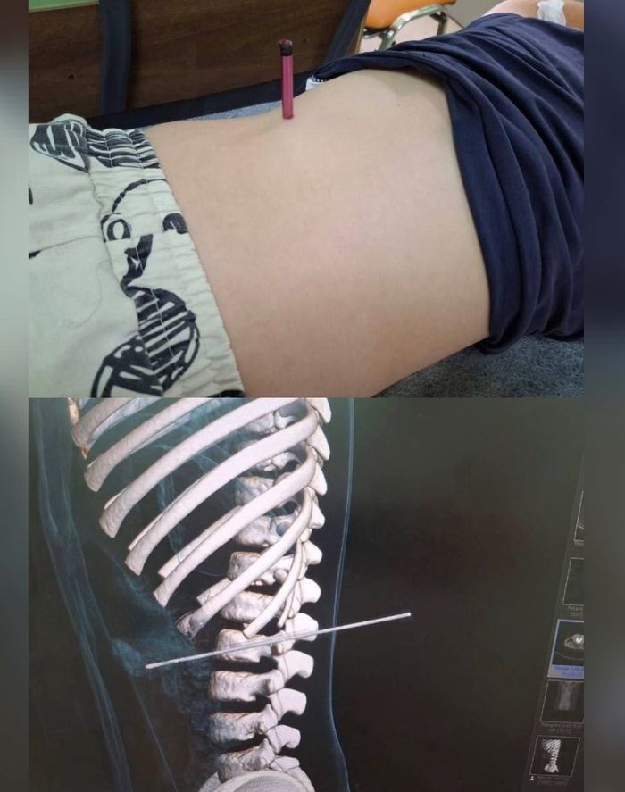 Звичайний олівець мало не вбив дитину