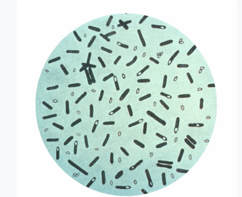 Два випадки ботулізму зафіксували у Вінницькій області