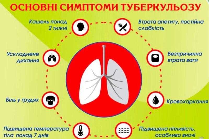 Туберкульоз на Вінниччині: 321 випадок за пів року, — ТЦПХ