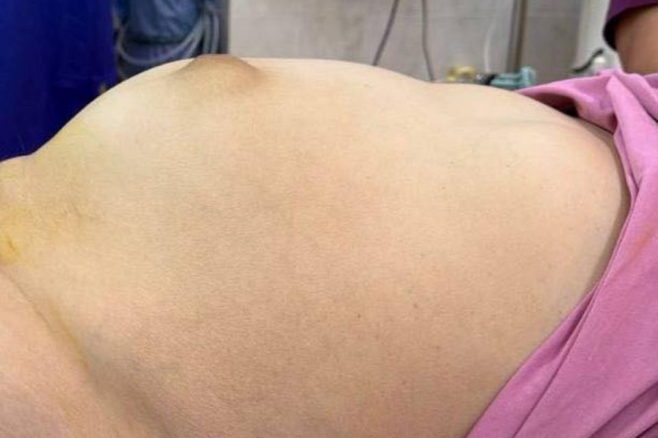 Вінницькі хірурги успішно провели унікальну операцію