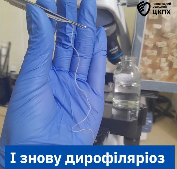 Обережно, небезпечні комарі