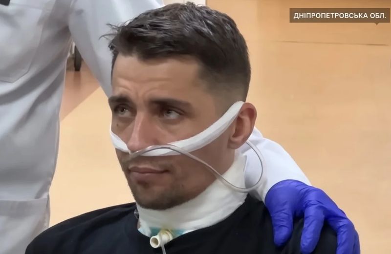 З перерізаним горлом 5 діб добирався до своїх позицій