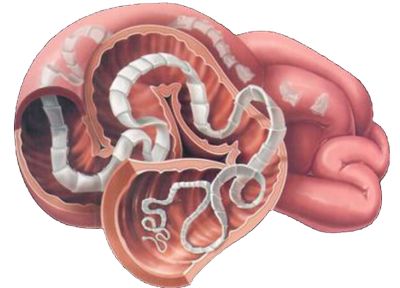 Після поїздки до Таїланду у вінничанки виявили небезпечного паразита