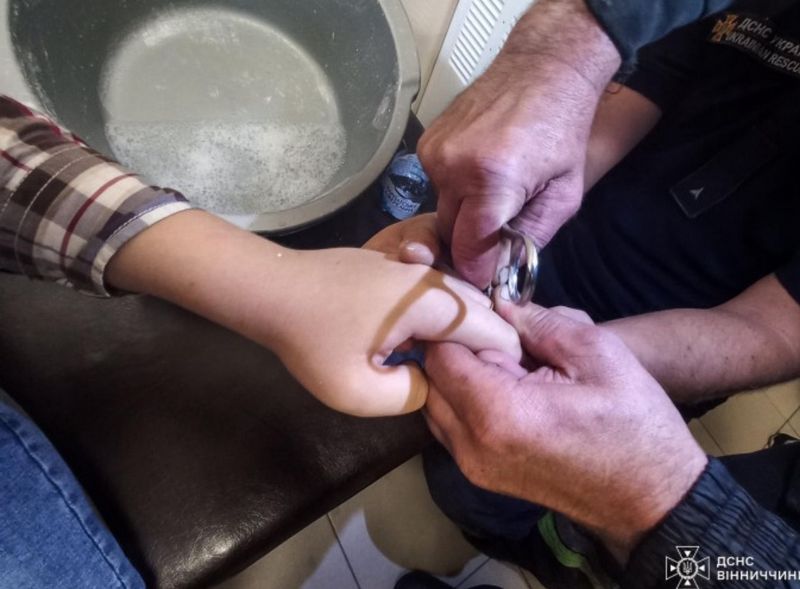 Каблучка перетисла палець 17-річної дівчини у Вінниці. Знімали рятувальники