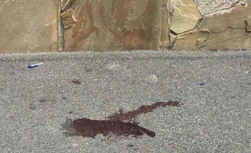 У Вінниці чоловік загинув, вистрибнувши з 11-го поверху