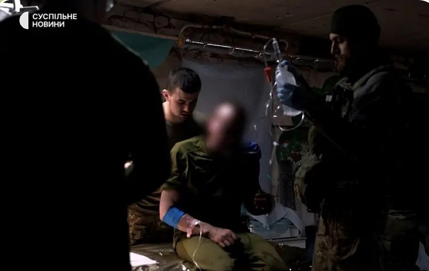 В Україні 98% поранень на фронті — не вогнепальні, а від вибухів і осколків, — стверджують медики