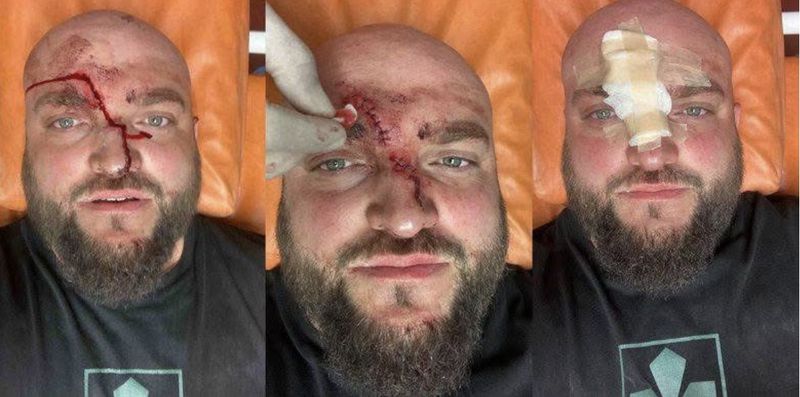 За мову – пробита голова і переломи у воїна, який приїхав на відпочинок із родиною до Затоки
