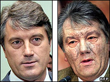 Балога назвав причетних до отруєння Ющенка у 2004 році